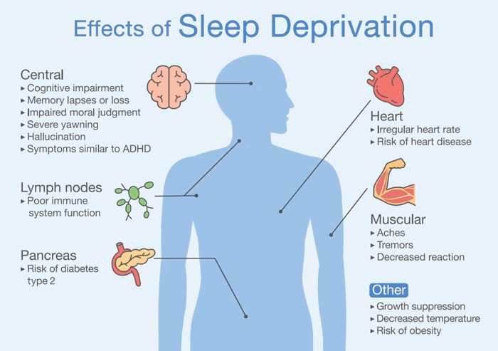 Effects of Sleep Deprivation